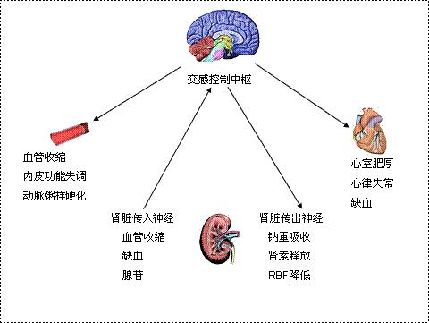 交感神经手术